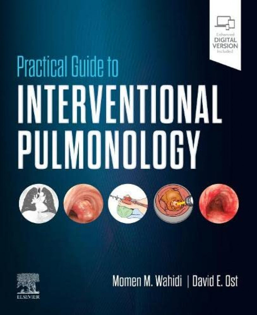 Practical guide to interventional pulmonology