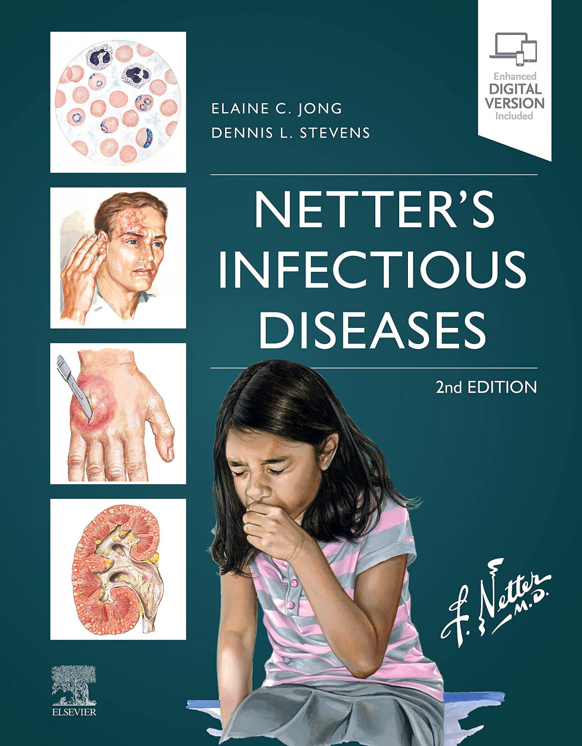 Netter' s infectious diseases