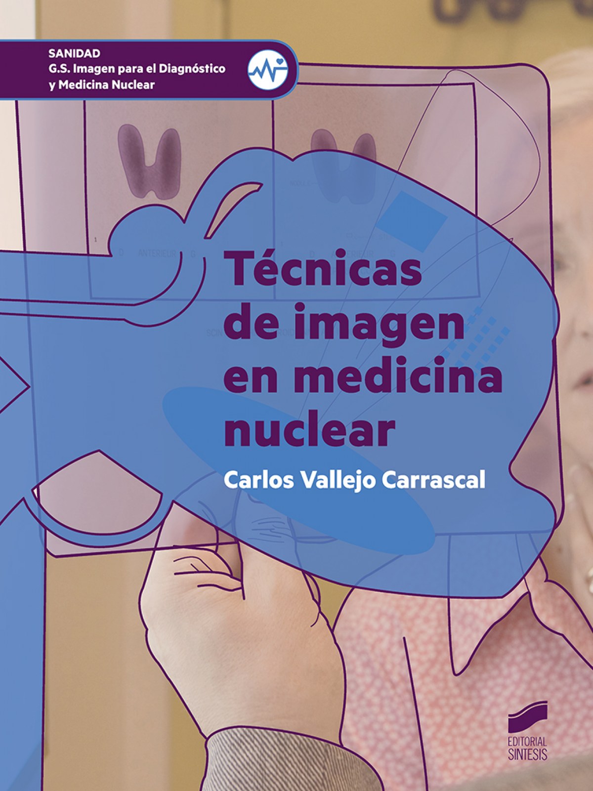 TÉCNICAS DE IMAGEN EN MEDICINA NUCLEAR. GRADO SUPERIOR
